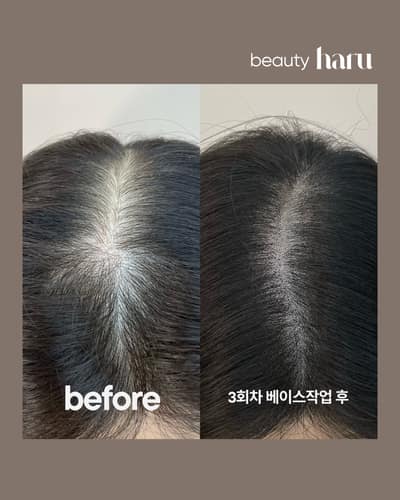 [인천 연수구] 뷰티하루 송도두피문신 체험단