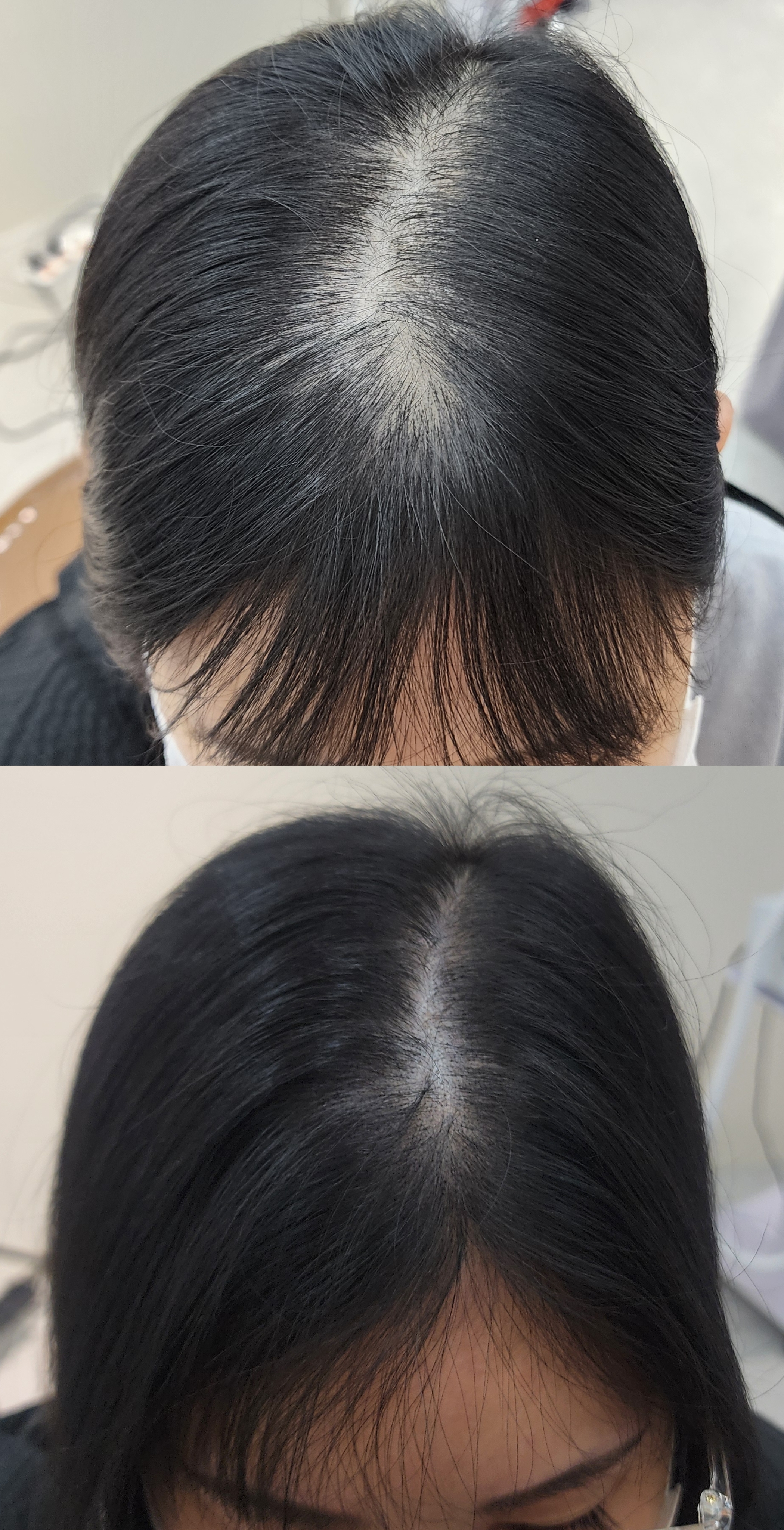 경북 경산시 뷰티 추천 | 뷰티블룸 경산점 체험단 모집