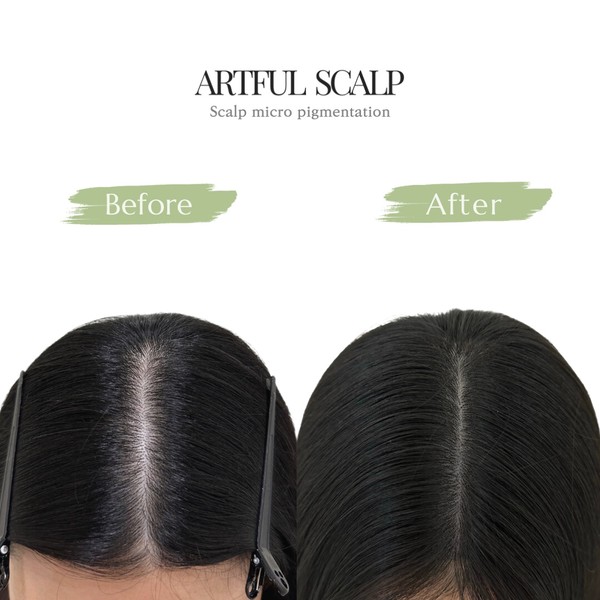 [부산 해운대] 아트풀스칼프 (artful scalp) 체험단